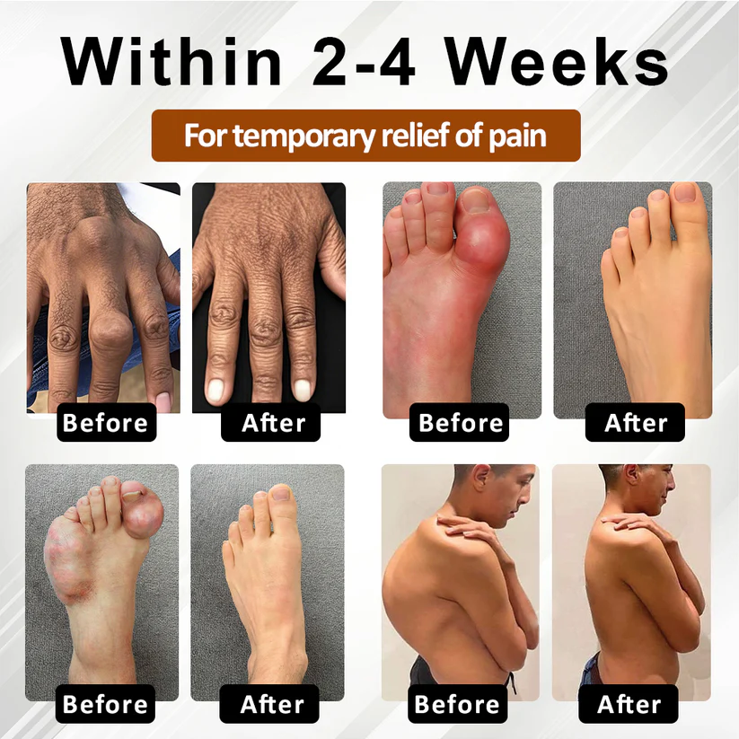 NovaRX® MagniBee Joint Support Formula Spray