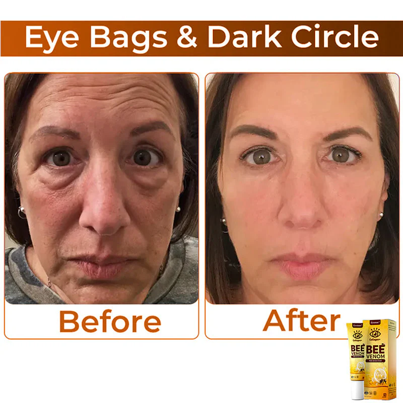Fivfivgo™ Collagen+ Bienengift Wake Up Augencreme