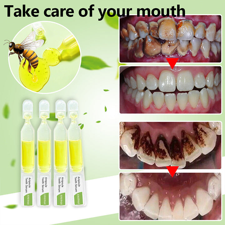 Fivfivgo™ Dentifrice Ampoule au Venin d'abeille de Nouvelle-Zélande