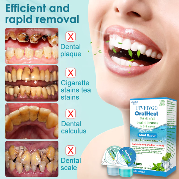 Fivfivgo™ OralHeal Mundwasser – entfernt Zahnstein, hellt die Zähne auf, beugt Mundgeschwüren und Karies vor und behandelt sie, beseitigt Mundgeruch