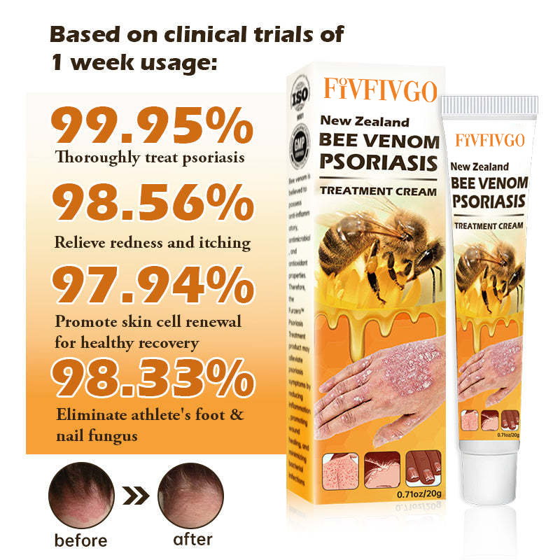 Fivfivgo™ Neuseeland Bienengift Psoriasis Behandlung Creme