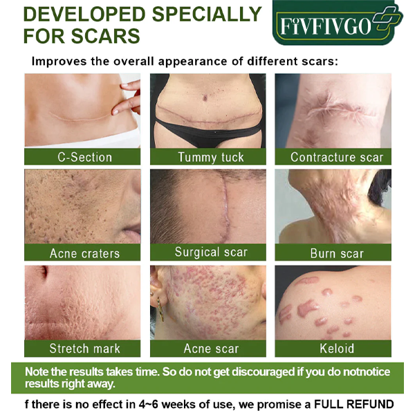 Fivfivgo™ Advanced Scar Repair Serum für alle Arten von Narben – insbesondere Aknenarben, Operationsnarben und Dehnungsstreifen