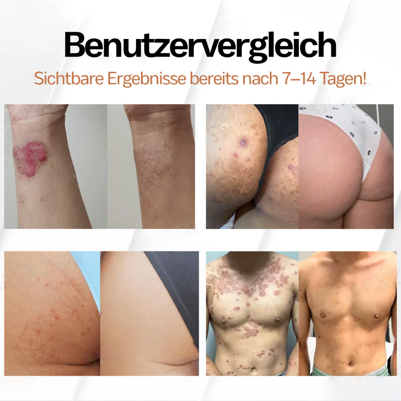 Fivfivgo® Neuseeland Manuka Honig All-in-One-Creme