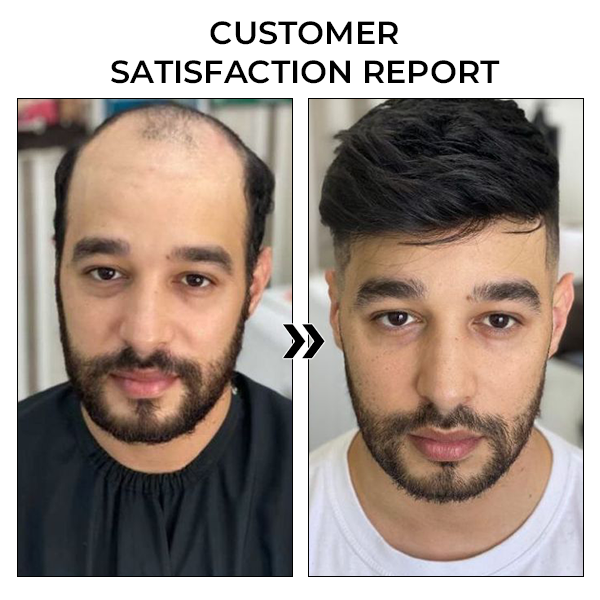 ✅Offizieller Shop: Fivfivgo™ BeeGrow Follicle Reviving Hair Essence 🌿 Anerkannt von AHLA & USP (klinisch erwiesen, um Haarfollikel zu aktivieren, die Gesundheit der Kopfhaut zu verbessern, Entzündungen zu reduzieren und Haarausfall zu verhindern)