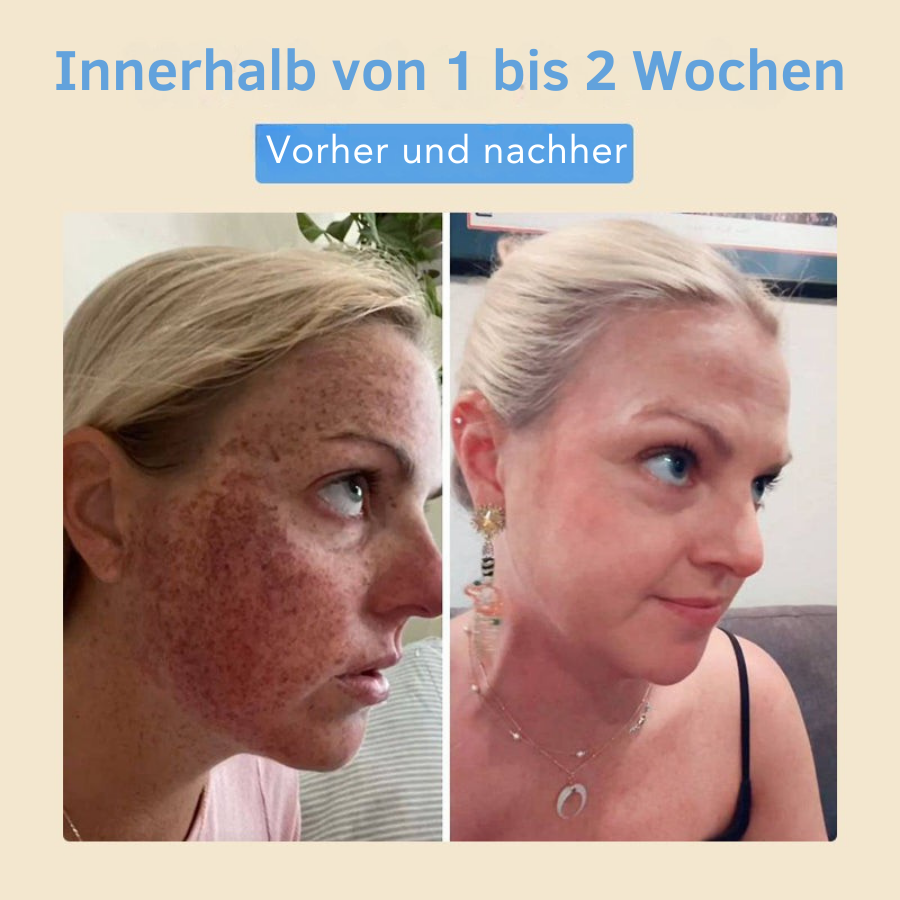 Fivfivgo® Bohnen-Essenz-Serum – Schält sanft, spendet Feuchtigkeit und hilft, dunkle Flecken zu verblassen