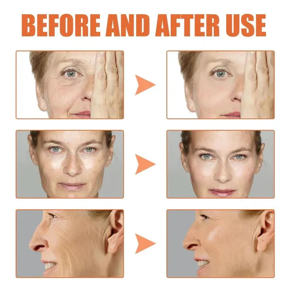 Fivfivgo™ Botox Facial Serum
