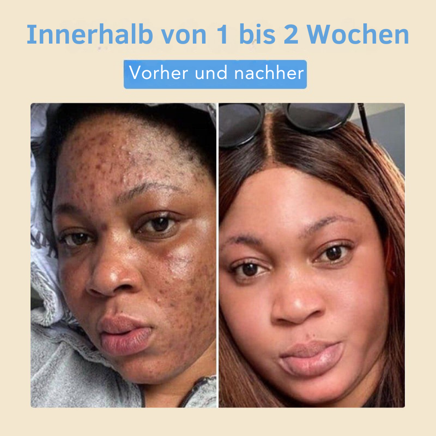 Fivfivgo® Bohnen-Essenz-Serum – Schält sanft, spendet Feuchtigkeit und hilft, dunkle Flecken zu verblassen