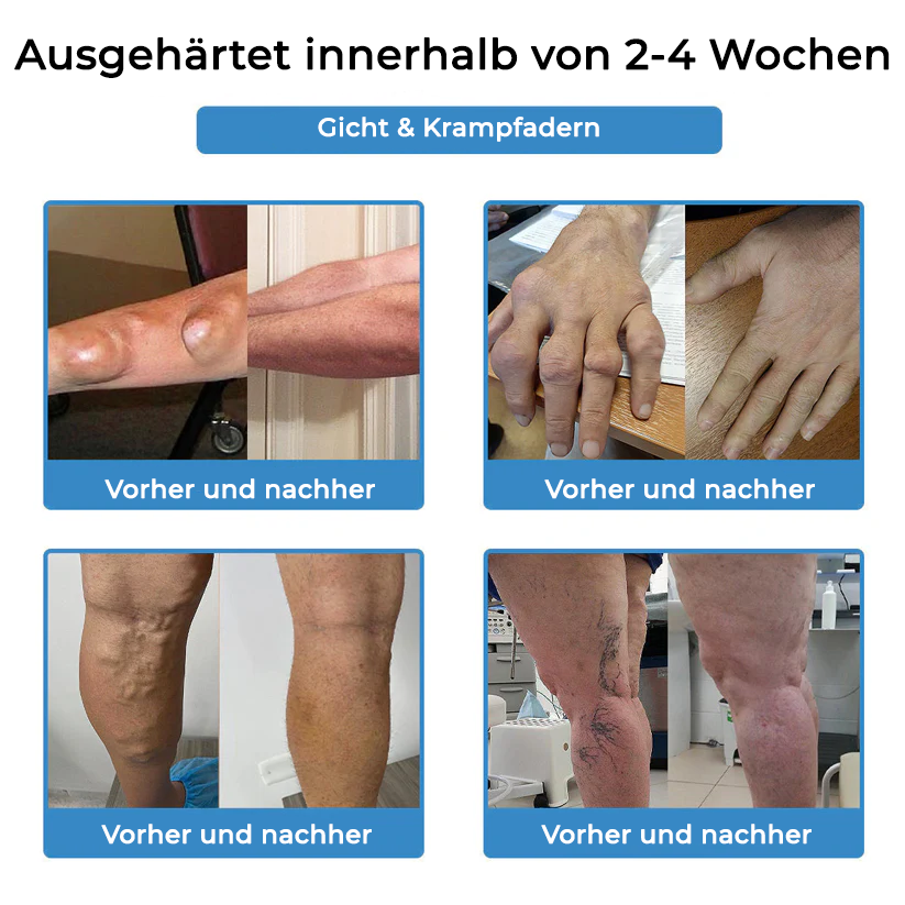 ✅ Offizieller Laden: Fivfivgo® Nano-Mikronadel-Gelenkpflaster