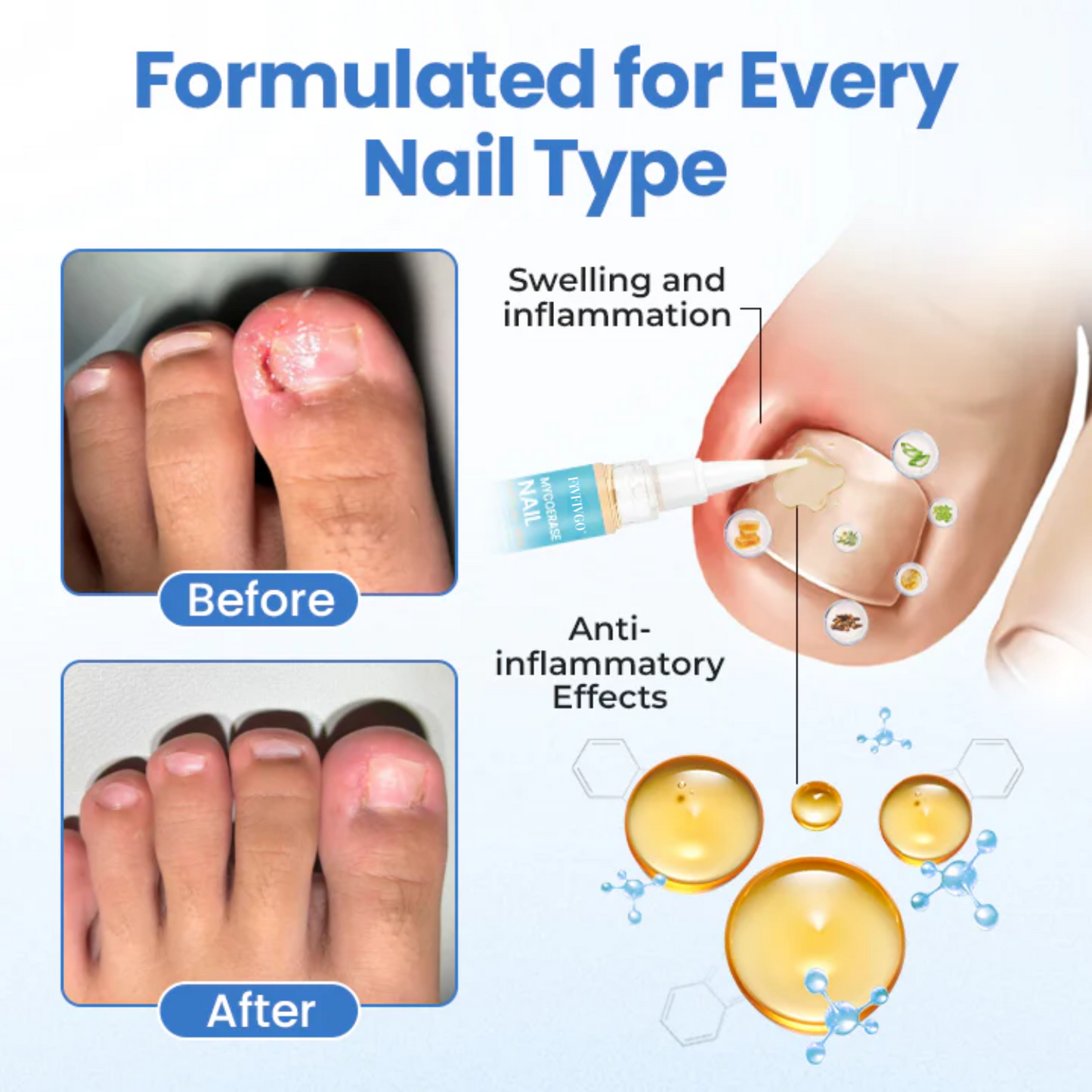 Fivfivgo® MycoErase Nail Revive Pen