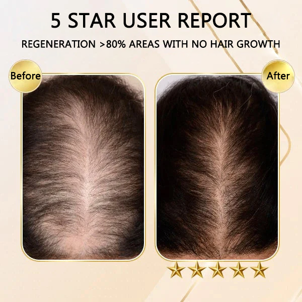 Fivfivgo™ Ginger Hair Growth Shampoo Bar