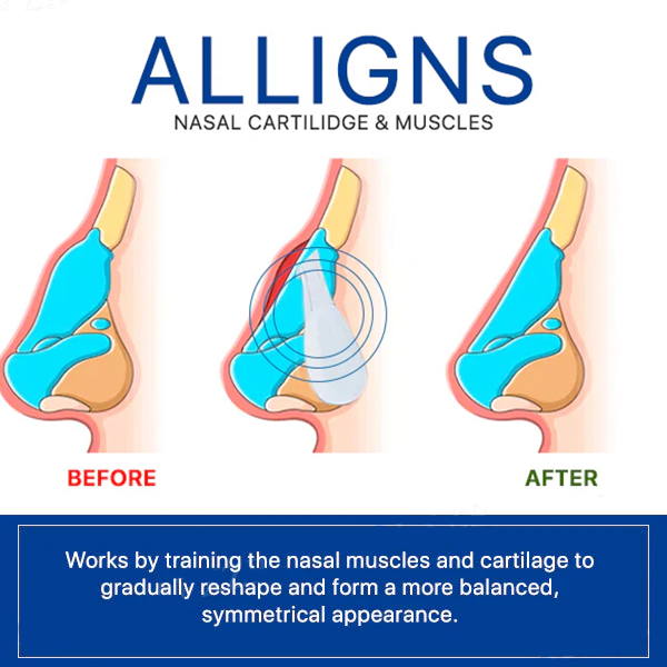Fivfivgo™ Nose Corrector Device