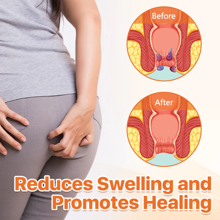 Fivfivgo™ Dual-Action Hemorrhoid Repair Cream