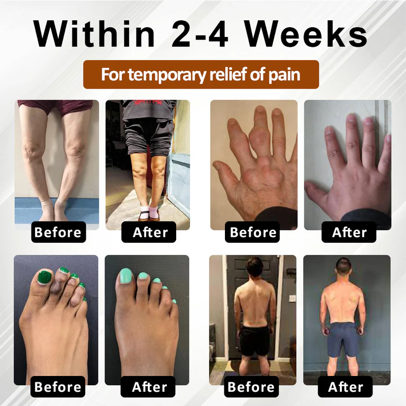 NovaRX® MagniBee Joint Support Formula Spray