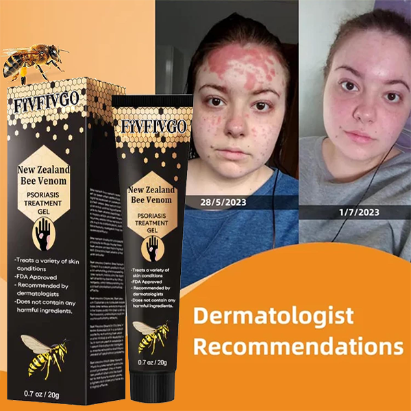 Fivfivgo™ New Zealand Bee Venom Psoriasis Treatment Gel