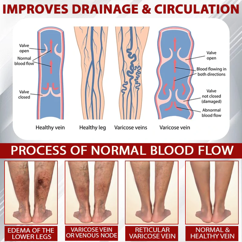 NovaRX® Red Vine FluidRelief Edema Gel