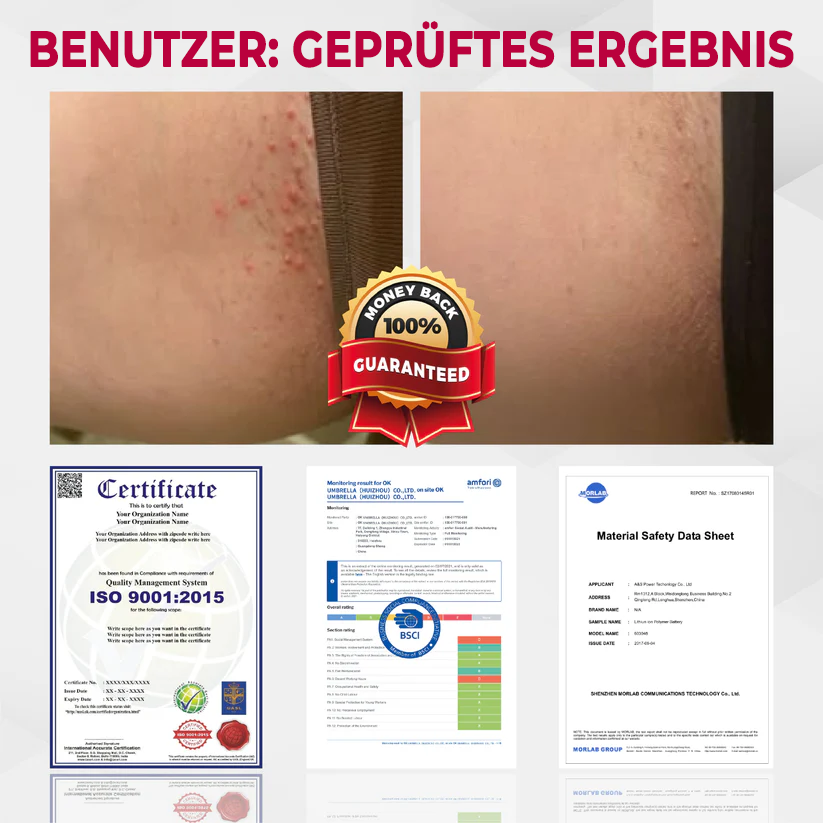 Fivfivgo® Genitalien der Frau HPV-Heilcreme