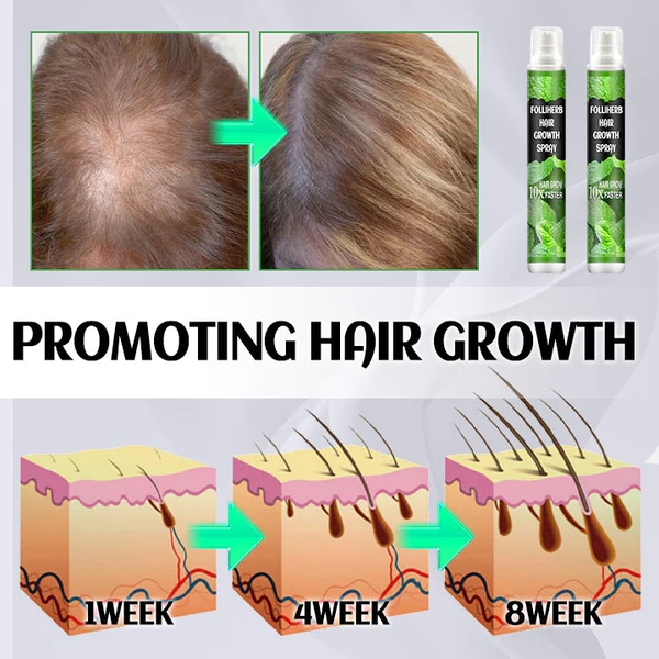 Fivfivgo™ FolliHerb Spray pour la croissance des cheveux