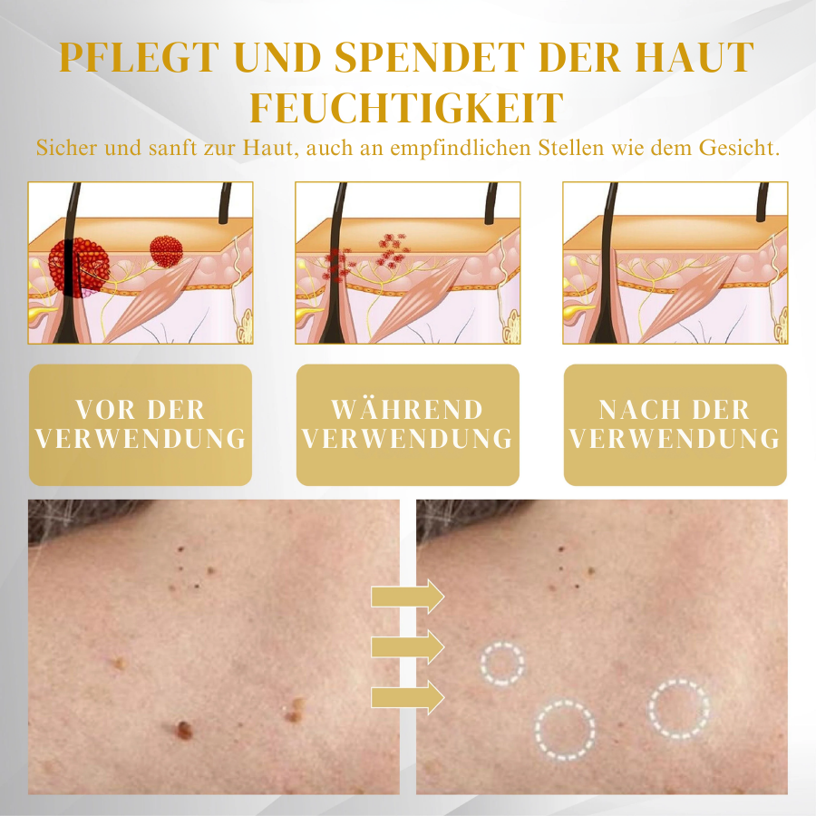 Fivfivgo® Fortschrittliches Maulwurf & Fleck Korrigierendes Bienengel