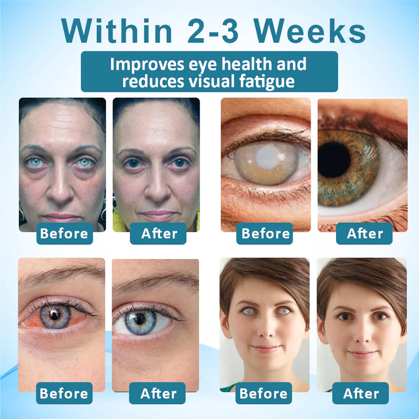 Fivfivgo™ Clarity Care Advanced Eye Drops