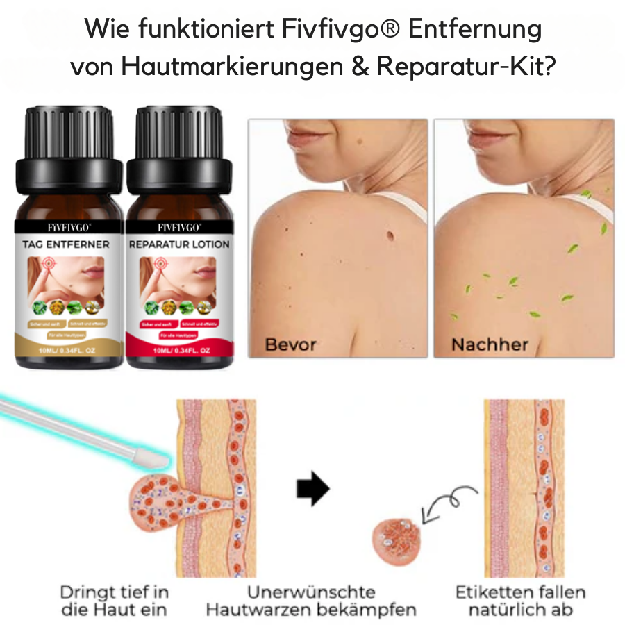 Fivfivgo® Entfernung von Hautmarkierungen & Reparatur-Kit