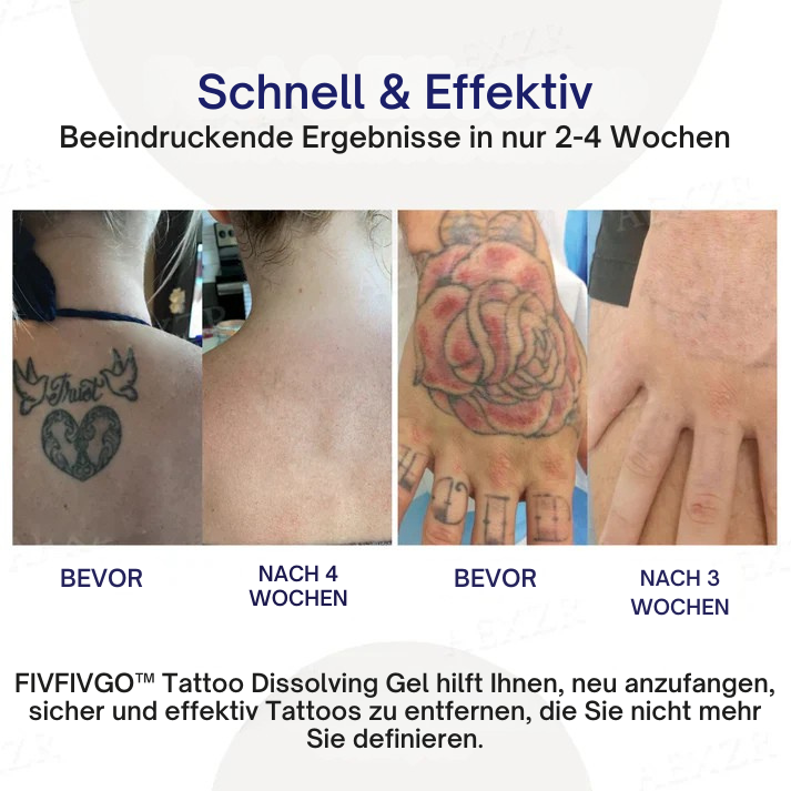 Fivfivgo™ Tattoo-Löschgel