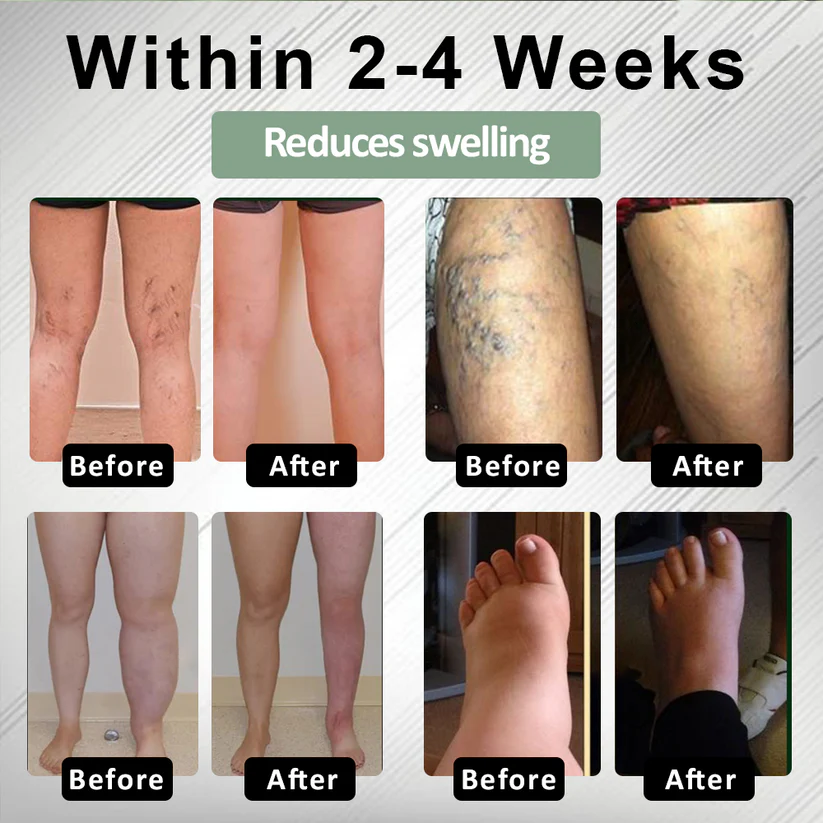 NovaRX® FlowBoost Edema Drain Herbal Roll On