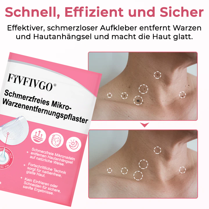 Fivfivgo® Schmerzfreies Mikro-Warzenentfernungspflaster