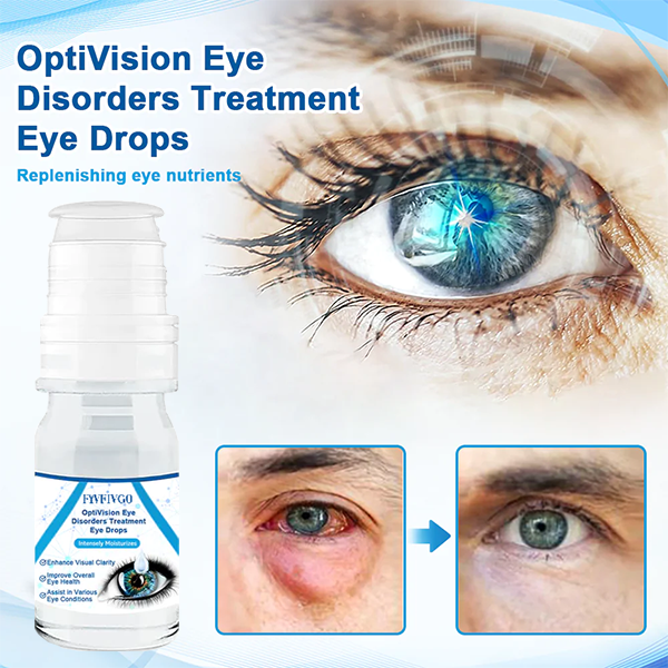 Fivfivgo™ OptiVision, gouttes pour les yeux pour le traitement des troubles oculaires