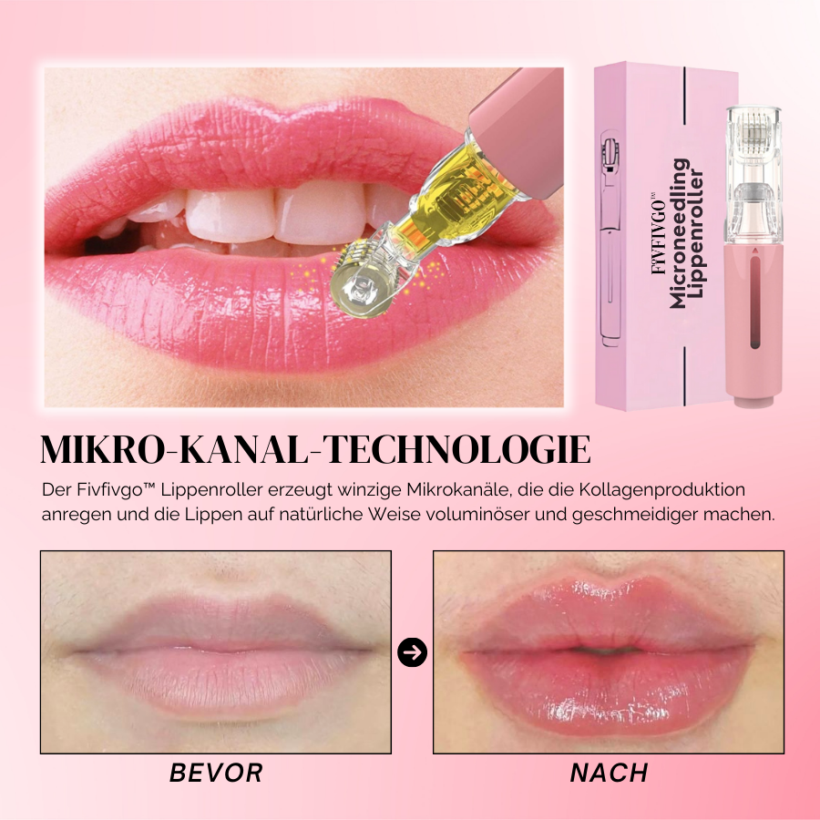 Fivfivgo™ MicroneedIing Lippenroller | Werkzeug zum Lippenauffüllen für Zuhause