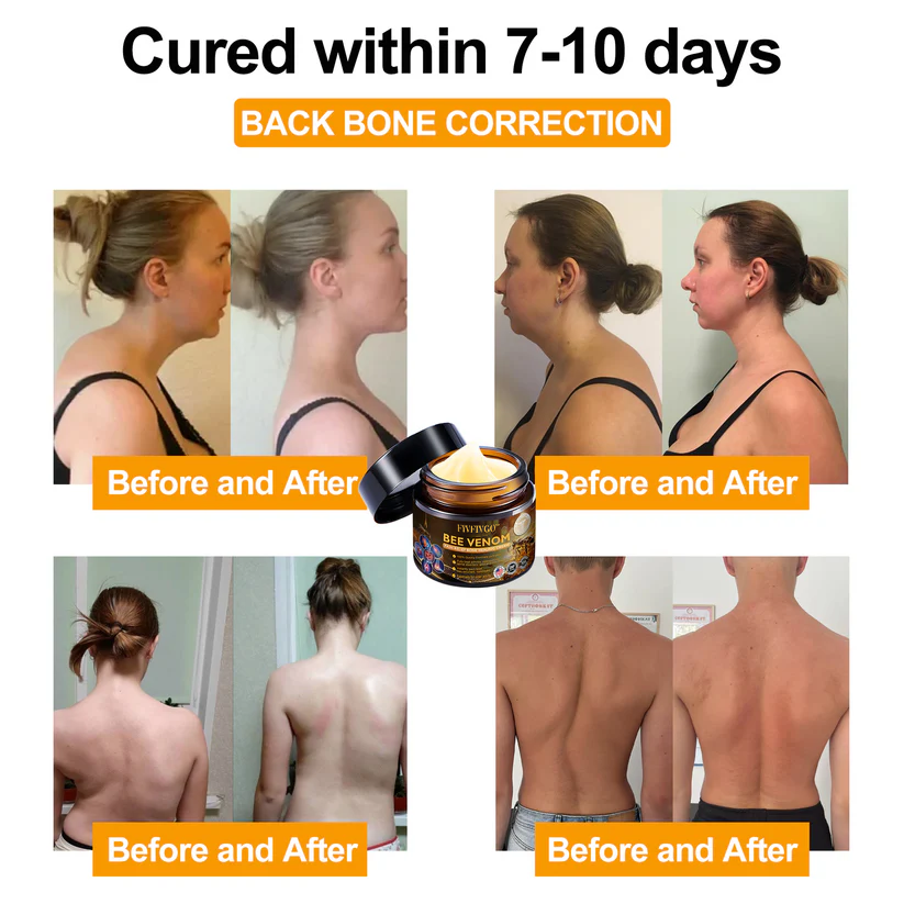 Fivfivgo™ Bee Venom Arthritis Therapy Cream (Specially for older adults & AAOS recommends)