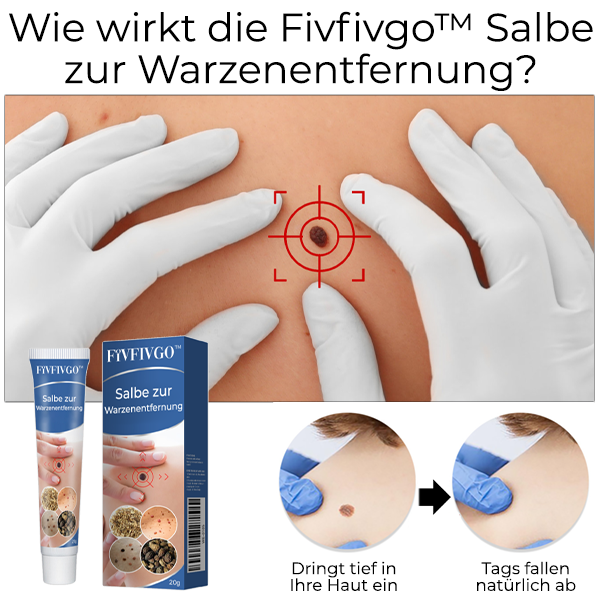 Fivfivgo™ Salbe zur Warzenentfernung