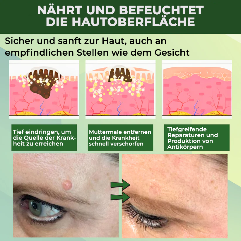 Fivfivgo® Reedle Shot 100 Tag & Spot Zielscheibe Fortgeschrittenes Serum