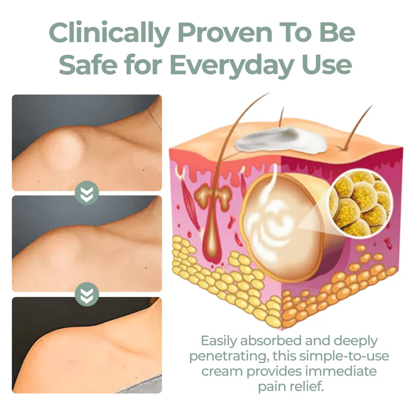 Fivfivgo® Lipoma Herbal Relief Cream