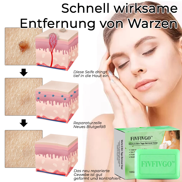 Fivfivgo™ Seife zur Entfernung von Warzen und Hautanhängseln