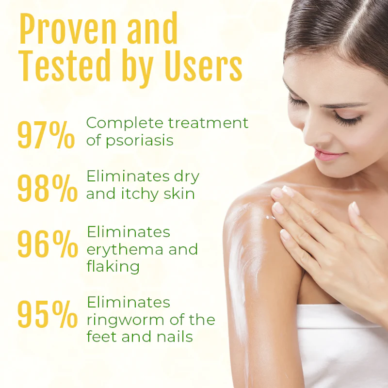 Fivfivgo™ PsorHeal Mehrzweck-Psoriasis-Creme