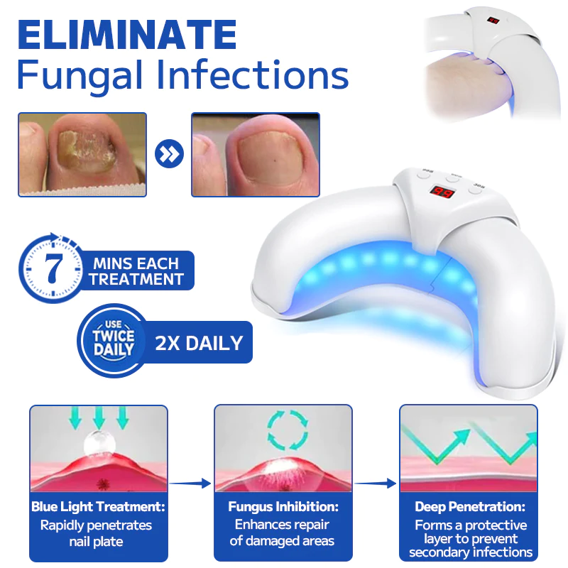 Fivfivgo™ Dispositif Laser de Traitement des Ongles Fongiques