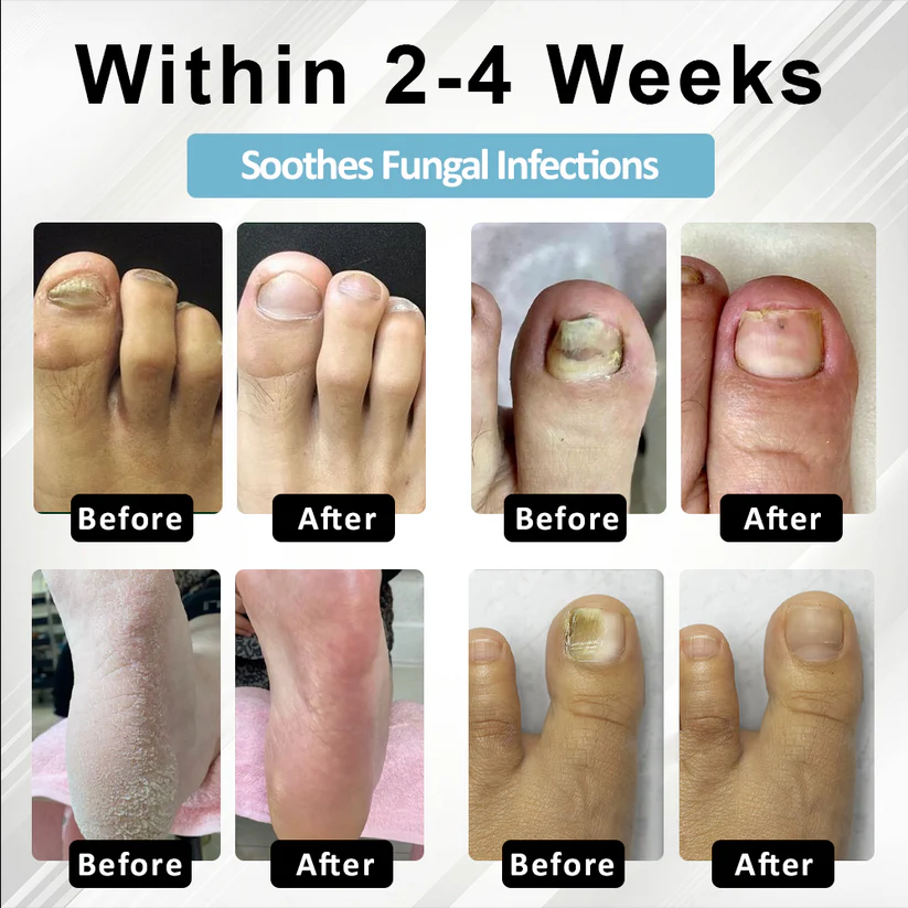 Fivfivgo® MycoStop Nail Recovery Serum Pen