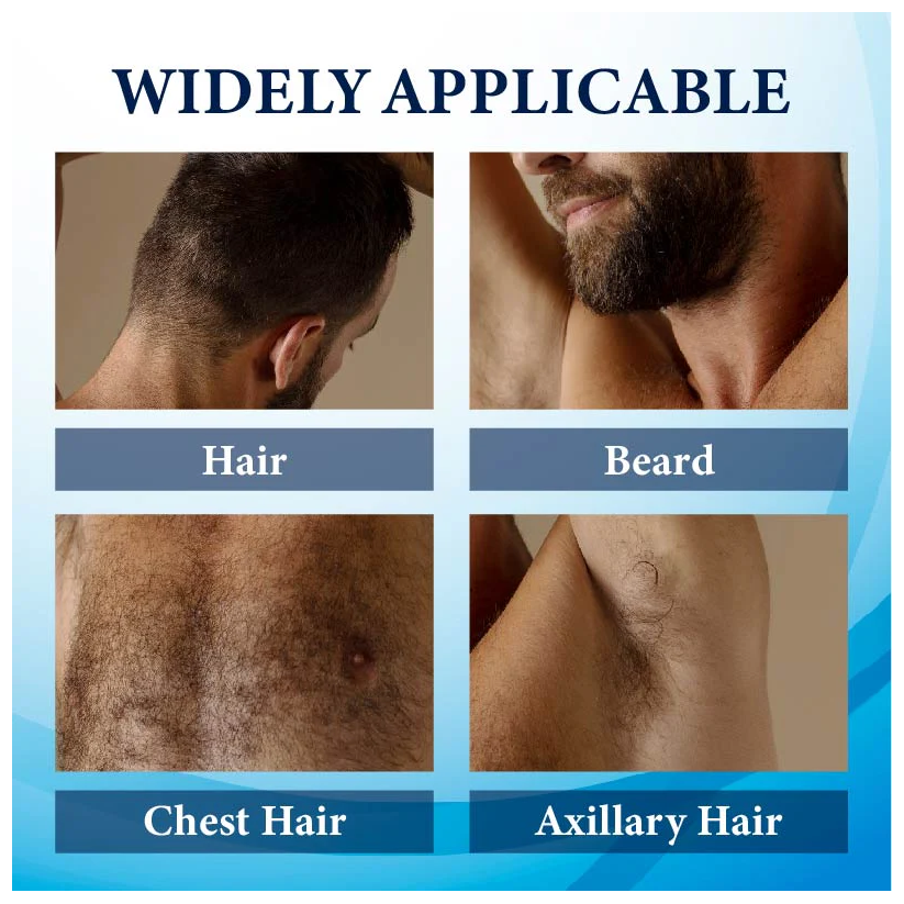 Fivfivgo™ ThickBoost Herbal HairGrowth Serum for Men