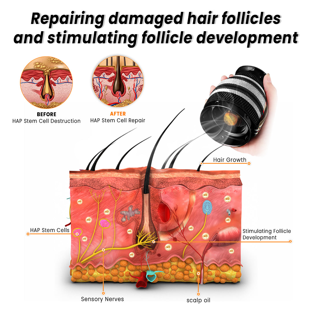 Fivfivgo™ Moxibustion Haarwuchs Gerät