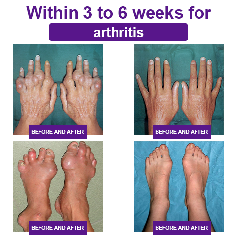 Fivfivgo™ Beinwell Bio Kräutersalbe