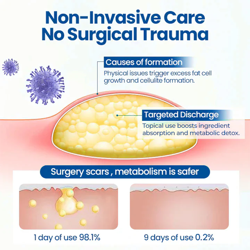 Fivfivgo® Lipoma Removal Cream
