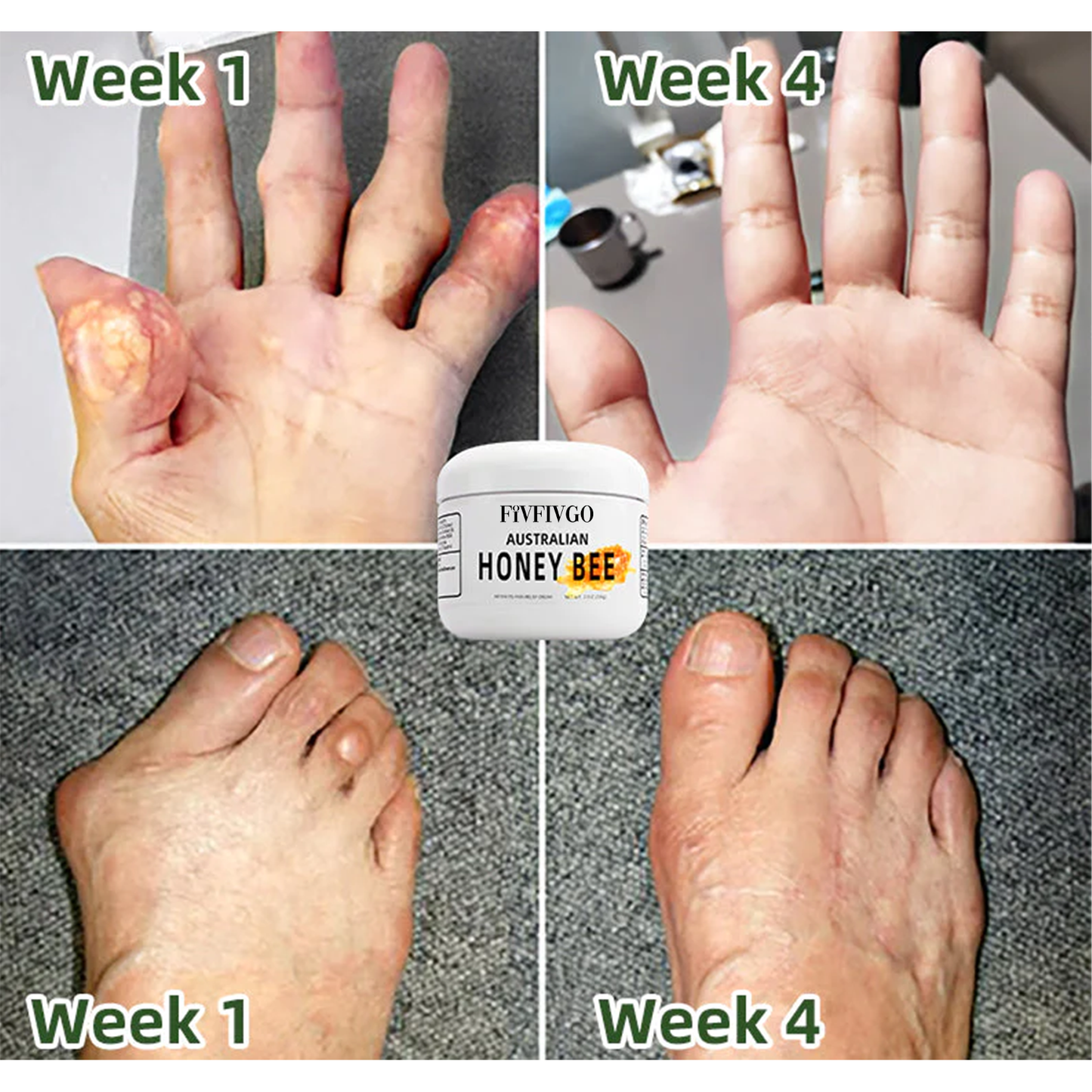 Fivfivgo™ Australian Honey Bee Venom Pain and Bone Healing Cream