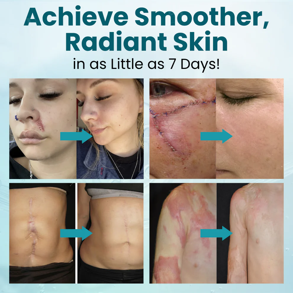 Fivfivgo® Advanced Scar Gel