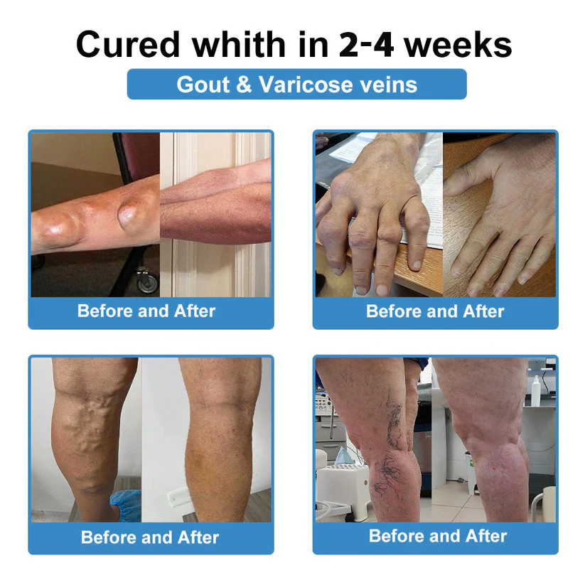 ✅ Official Store: Fivfivgo® Nano-Microneedle Joint Patch