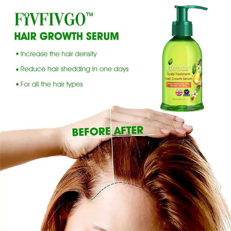 Fivfivgo™ Scalp Treatment Hair Grᴏᴡth Serum