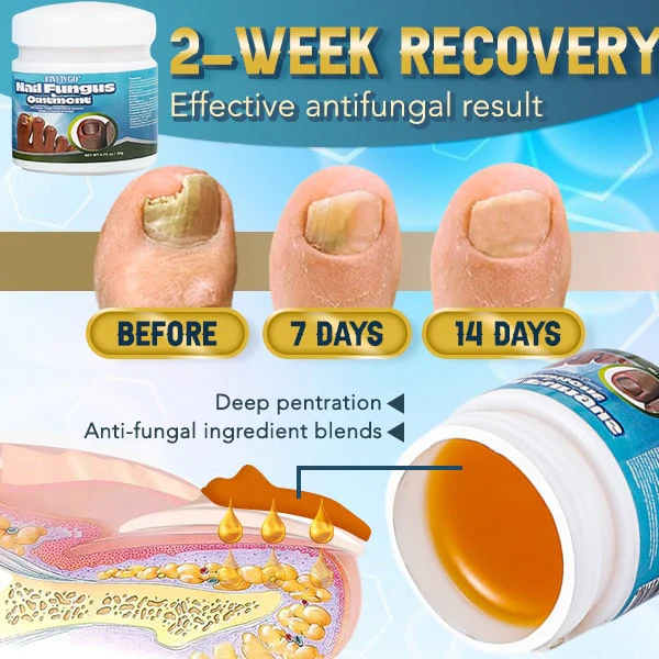 Fivfivgo™ 5X Schnellheilende Nagelpilzsalbe