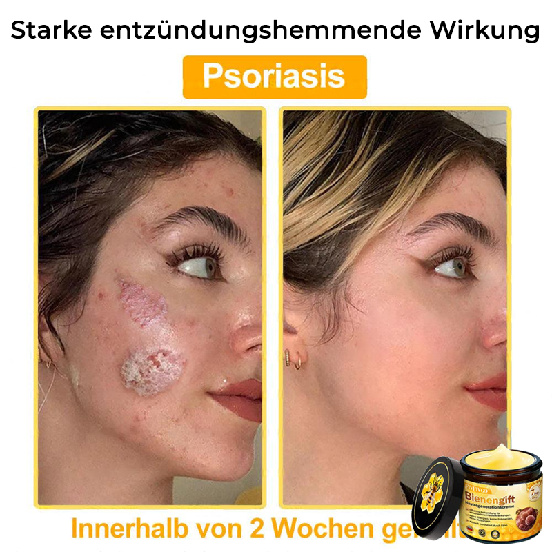 Fivfivgo™ Bienengift Hautregenerationscreme