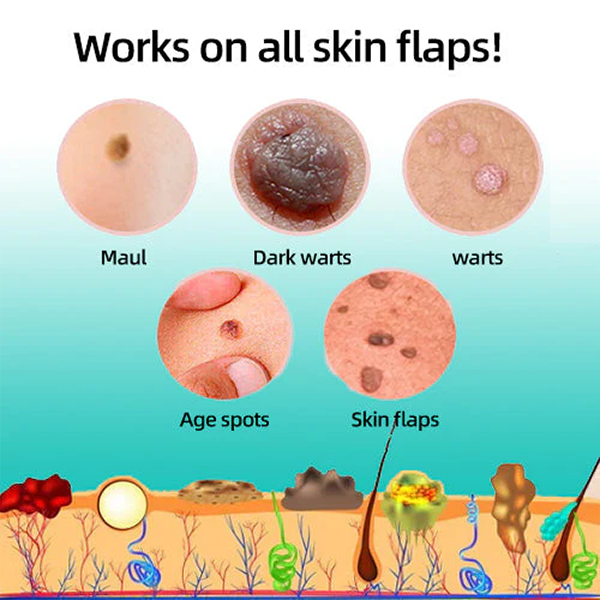 Fivfivgo™ Tags & Moles Remover Pen