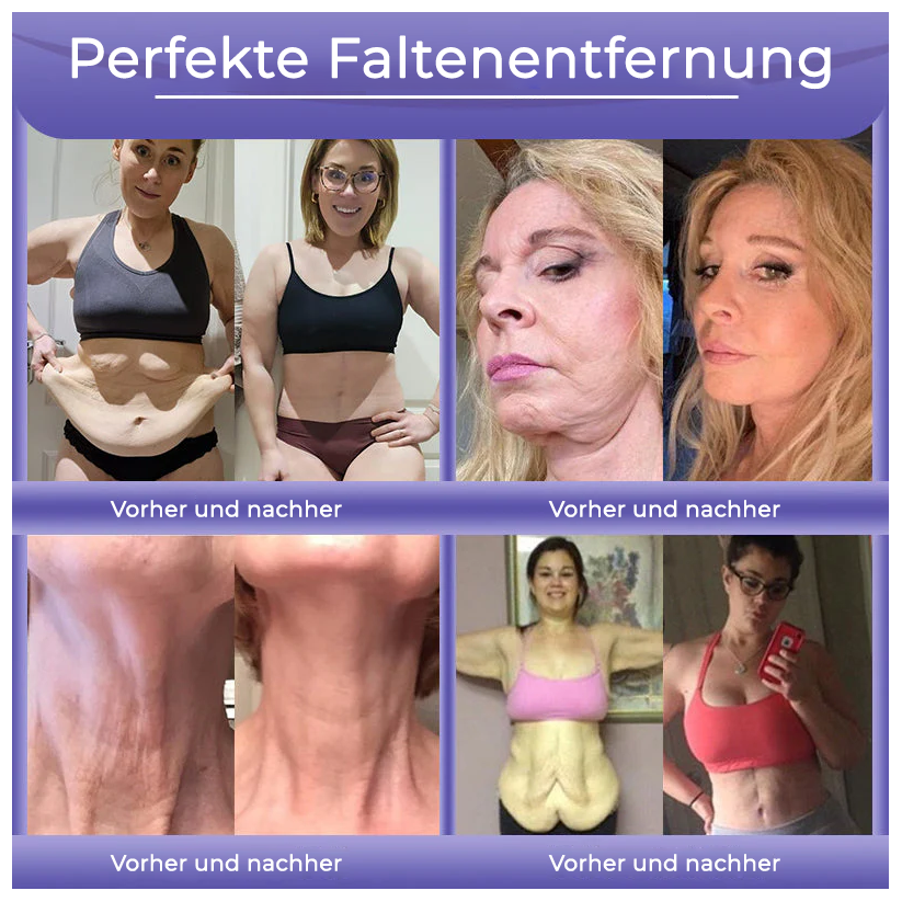 Fivfivgo® Anti-Falten-Hautcreme zum Entfernen von Falten, Straffen der Haut, Aufhellen - Last Day Sale🔥90% OFF