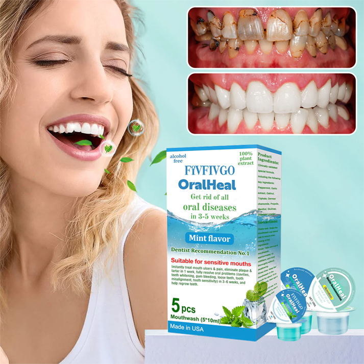 Fivfivgo™ OralHeal Mundwasser – entfernt Zahnstein, hellt die Zähne auf, beugt Mundgeschwüren und Karies vor und behandelt sie, beseitigt Mundgeruch